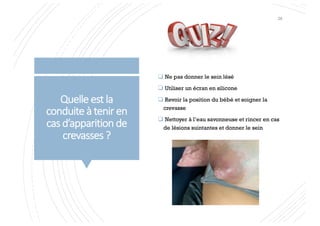 Quelle est la
conduite à tenir en
cas d’apparition de
crevasses ?
q Ne pas donner le sein lésé
q Utiliser un écran en silicone
q Revoir la position du bébé et soigner la
crevasse
q Nettoyer à l’eau savonneuse et rincer en cas
de lésions suintantes et donner le sein
28
 