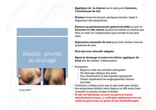 Mastite : priorité
au drainage
• Appliquer de la chaleur sur le sein pour favoriser
l’écoulement de lait.
• Drainer toutes les heures, quelques minutes, jusqu’à
disparition des symptômes.
• Assurer un positionnement optimal du bébé au sein et
favoriser le côté atteint (parfois les bébés ne veulent pas
téter ce côté car l’inflammation peut rendre le lait plus
salé).
• Expression manuelle du sein pour bien draîner tous les
quadrants du sein
• Tire-lait avec téterelle adaptée.
• Après le drainage et entres les tétées: appliquer du
froid afin de réduire l’inflammation.
§ Prévention
§ Repos et aide aux activités ménagères
§ Un drainage adéquat des seins
§ Une alimentation et des liquides appropriés
§ Traiter rapidement les engorgements/canaux
bouchés
§ Continuer à allaiter pour que le sein reste bien draîné
§ Les symptomes doivent avoir disparu en 48h sinon faire
consulter la maman (risque d’abcès)
§ Si elle est bilatérale ou avec un porte d’entrée
infectieuse(crevasse..), redirigez également vers un
médecin pour mise en place d’une antibiothérapie
Photos RSPP
66
 