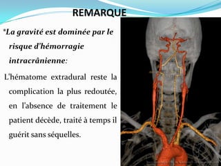 REMARQUE
*La gravité est dominée par le
 risque d’hémorragie
 intracrânienne:

L’hématome extradural reste la
 complication la plus redoutée,
 en l’absence de traitement le
 patient décède, traité à temps il
 guérit sans séquelles.
 