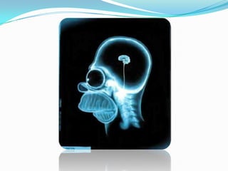 Cours polytraumatisé & rachis