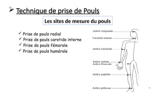 50
 Prise de pouls radial
 Prise de pouls fémorale
 Prise de pouls carotide interne
 Prise de pouls humérale
Les sites de mesure du pouls
 Technique de prise de Pouls
 