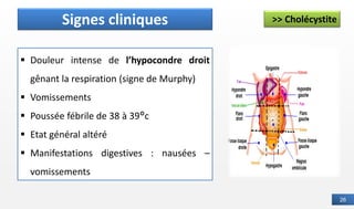 Signe Murphy Cours soins infirmiers en chirurgie (3éme partie) | PDF