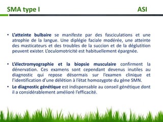 • L’atteinte bulbaire se manifeste par des fasciculations et une
atrophie de la langue. Une diplégie faciale modérée, une atteinte
des masticateurs et des troubles de la succion et de la déglutition
peuvent exister. L’oculomotricité est habituellement épargnée.
• L’électromyographie et la biopsie musculaire confirment la
dénervation. Ces examens sont cependant devenus inutiles au
diagnostic qui repose désormais sur l’examen clinique et
l’identification d’une délétion à l’état homozygote du gène SMN.
• Le diagnostic génétique est indispensable au conseil génétique dont
il a considérablement amélioré l’efficacité.
SMA type I ASI
 