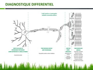 DIAGNOSTIQUE DIFFERENTIEL
 