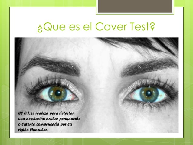 Examenes de estrabismo: Cover test | PPTX