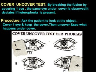 COVER UNCOVER TEST: By breaking the fusion by
covering 1 eye , the same eye under cover is observed.It
deviates if heterophoria is present.
Procedure: Ask the patient to look at the object .
Cover 1 eye & keep the cover.Then uncover &see what
happens under cover.
 