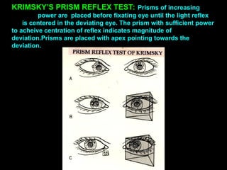 KRIMSKY’S PRISM REFLEX TEST: Prisms of increasing
power are placed before fixating eye until the light reflex
is centered in the deviating eye. The prism with sufficient power
to acheive centration of reflex indicates magnitude of
deviation.Prisms are placed with apex pointing towards the
deviation.
 