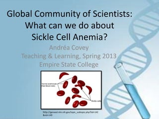 Global Community of Scientists:
    What can we do about
      Sickle Cell Anemia?
            Andréa Covey
   Teaching & Learning, Spring 2013
         Empire State College




          http://geneed.nlm.nih.gov/topic_subtopic.php?tid=142
          &sid=149
 