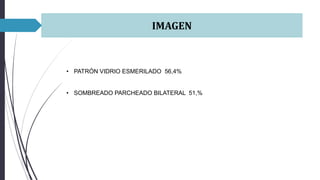 IMAGEN
• PATRÓN VIDRIO ESMERILADO 56,4%
• SOMBREADO PARCHEADO BILATERAL 51,%
 