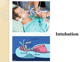 Intubation
 