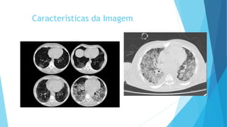 Características da Imagem
 