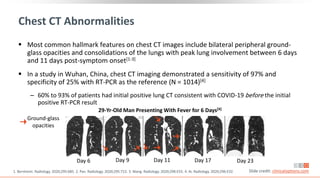 Chest CT Abnormalities
 Most common hallmark features on chest CT images include bilateral peripheral ground-
glass opacities and consolidations of the lungs with peak lung involvement between 6 days
and 11 days post-symptom onset[1-3]
 In a study in Wuhan, China, chest CT imaging demonstrated a sensitivity of 97% and
specificity of 25% with RT-PCR as the reference (N = 1014)[4]
‒ 60% to 93% of patients had initial positive lung CT consistent with COVID-19 before the initial
positive RT-PCR result
1. Bernheim. Radiology. 2020;295:685. 2. Pan. Radiology. 2020;295:715. 3. Wang. Radiology. 2020;296:E55. 4. Ai. Radiology. 2020;296:E32. Slide credit: clinicaloptions.com
29-Yr-Old Man Presenting With Fever for 6 Days[4]
Ground-glass
opacities
Day 6 Day 9 Day 11 Day 17 Day 23
 