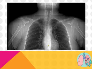 LABS Y TAC SIMPLE DE TÓRAX
 