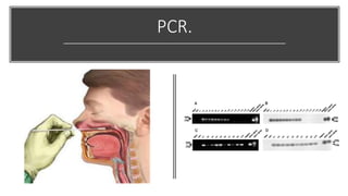 PCR.
 