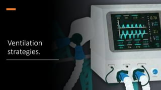 Ventilation
strategies.
 
