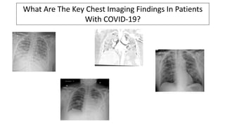 What Are The Key Chest Imaging Findings In Patients
With COVID-19?
 