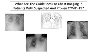 What Are The Guidelines For Chest Imaging In
Patients With Suspected And Proven COVID-19?
 