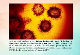 Covid 19 (novel corona virus) | PDF