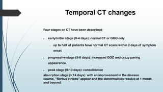 Temporal CT changes
Four stages on CT have been described:
 early/initial stage (0-4 days): normal CT or GGO only
o up to half of patients have normal CT scans within 2 days of symptom
onset
 progressive stage (5-8 days): increased GGO and crazy paving
appearance.
 peak stage (9-13 days): consolidation
absorption stage (> 14 days): with an improvement in the disease
course, "fibrous stripes" appear and the abnormalities resolve at 1 month
and beyond.
 