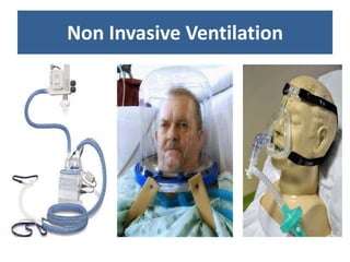 Non Invasive Ventilation
 