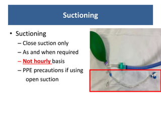 Suctioning
• Suctioning
– Close suction only
– As and when required
– Not hourly basis
– PPE precautions if using
open suction
 