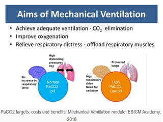 Aims of Mechanical Ventilation
• Achieve adequate ventilation - CO2 elimination
• Improve oxygenation
• Relieve respiratory distress - offload respiratory muscles
 