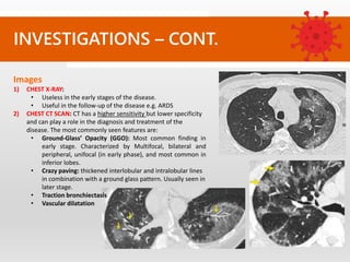 INVESTIGATIONS – CONT.
Images
1) CHEST X-RAY:
• Useless in the early stages of the disease.
• Useful in the follow-up of the disease e.g. ARDS
2) CHEST CT SCAN: CT has a higher sensitivity but lower specificity
and can play a role in the diagnosis and treatment of the
disease. The most commonly seen features are:
• Ground-Glass’ Opacity (GGO): Most common finding in
early stage. Characterized by Multifocal, bilateral and
peripheral, unifocal (in early phase), and most common in
inferior lobes.
• Crazy paving: thickened interlobular and intralobular lines
in combination with a ground glass pattern. Usually seen in
later stage.
• Traction bronchiectasis
• Vascular dilatation
 