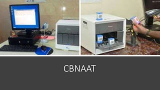 CBNAAT
 