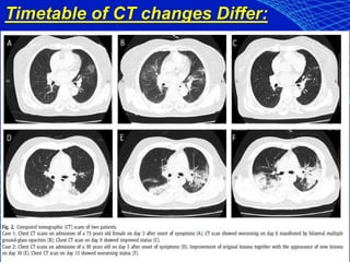Timetable of CT changes Differ:
 