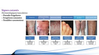 Signes cutanés
Dermatologiques/vasculaires:
‒ Pseudo-Engelures
‒ Eruptions cutanées
‒ Troubles vasomoteurs
 