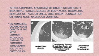 • ON ADMISSION,
GROUND‐GLASS
OPACITY IS THE
MOST
COMMON
RADIOLOGIC
FINDING ON
COMPUTED
TOMOGRAPHY
(CT) OF THE
CHEST (56.4%).
•OTHER SYMPTOMS: SHORTNESS OF BREATH OR DIFFICULTY
BREATHING, FATIGUE, MUSCLE OR BODY ACHES, HEADACHES,
NEW LOSS OF TASTE OR SMELL, SORE THROAT, CONGESTION
OR RUNNY NOSE, NAUSEA OR VOMITING.
 