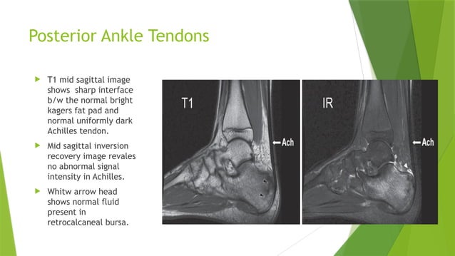 COW_ankle anatomy radiology with xrays and MRI | PPT