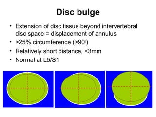 Imaging for back pain | PPT