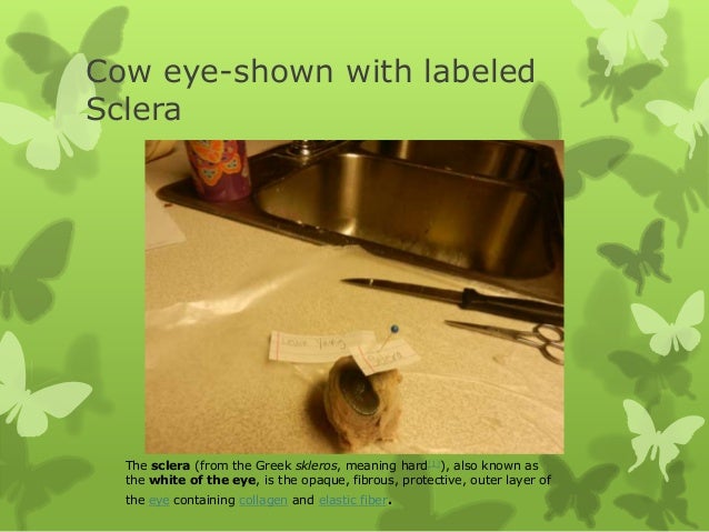 Cow eye – dissection and label