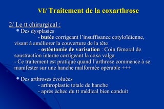 VI/VI/ Traitement de la coxarthroseTraitement de la coxarthrose
2/ Le tt chirurgical :2/ Le tt chirurgical :
Des dysplasiesDes dysplasies
-- butéebutée corrigeant l’insuffisance cotyloïdienne,corrigeant l’insuffisance cotyloïdienne,
visant à améliorer la couverture de la têtevisant à améliorer la couverture de la tête
-- ostéotomie de varisationostéotomie de varisation : Coin fémoral de: Coin fémoral de
soustraction interne corrigeant la coxa valgasoustraction interne corrigeant la coxa valga
- Ce traitement est pratiqué quand l’arthrose commence à se- Ce traitement est pratiqué quand l’arthrose commence à se
manifester sur une hanche malformée opérable +++manifester sur une hanche malformée opérable +++
Des arthroses évoluéesDes arthroses évoluées
- arthroplastie totale de hanche- arthroplastie totale de hanche
- après échec du tt médical bien conduit- après échec du tt médical bien conduit
 