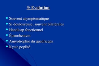 3/ Evolution3/ Evolution
 Souvent asymptomatiqueSouvent asymptomatique
 Si douloureuse, souvent bilatéralesSi douloureuse, souvent bilatérales
 Handicap fonctionnelHandicap fonctionnel
 ÉpanchementÉpanchement
 Amyotrophie du quadricepsAmyotrophie du quadriceps
 Kyste poplitéKyste poplité
 