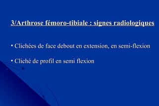3/Arthrose fémoro-tibiale : signes radiologiques3/Arthrose fémoro-tibiale : signes radiologiques
• Clichées de face debout en extension, en semi-flexionClichées de face debout en extension, en semi-flexion
• Cliché de profil en semi flexionCliché de profil en semi flexion
 