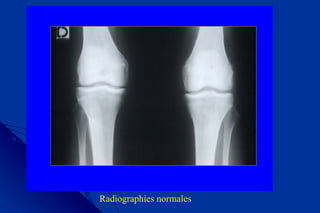 Radiographies normales
 