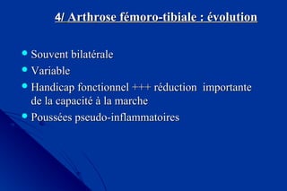 4/4/ Arthrose fémoro-tibiale : évolutionArthrose fémoro-tibiale : évolution
 Souvent bilatéraleSouvent bilatérale
 VariableVariable
 Handicap fonctionnel +++ réduction importanteHandicap fonctionnel +++ réduction importante
de la capacité à la marchede la capacité à la marche
 Poussées pseudo-inflammatoiresPoussées pseudo-inflammatoires
 