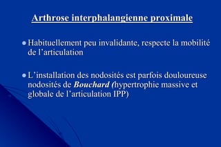 ArthroseArthrose interphalangienneinterphalangienne proximaleproximale
Habituellement peu invalidante, respecte la mobilitHabituellement peu invalidante, respecte la mobilitéé
de lde l’’articulationarticulation
LL’’installation des nodositinstallation des nodositéés est parfois douloureuses est parfois douloureuse
nodositnodositéés des de Bouchard (Bouchard (hypertrophie massive ethypertrophie massive et
globale de lglobale de l’’articulation IPP)articulation IPP)
 