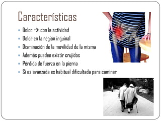 Características
Dolor con la actividad
Dolor en la región inguinal
Disminución de la movilidad de la misma
Además pueden existir crujidos
Pérdida de fuerza en la pierna
Si es avanzada es habitual dificultada para caminar