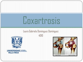 Coxartrosis
Laura Gabriela Domínguez Domínguez
                4010
 