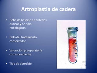 Artroplastia de cadera
• Debe de basarse en criterios
clínicos y no sólo
radiológicos.
• Fallo del tratamiento
conservador.

• Valoración preoperatoria
correspondiente.
• Tipo de abordaje.

 