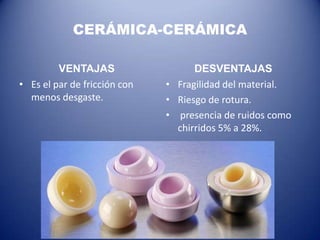 CERÁMICA-CERÁMICA
VENTAJAS
• Es el par de fricción con
menos desgaste.

DESVENTAJAS
• Fragilidad del material.
• Riesgo de rotura.
• presencia de ruidos como
chirridos 5% a 28%.

 