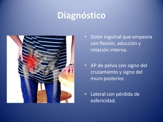 Diagnóstico
• Dolor inguinal que empeora
con flexión, aducción y
rotación interna.
• AP de pelvis con signo del
cruzamiento y signo del
muro posterior.
• Lateral con pérdida de
esfericidad.

 