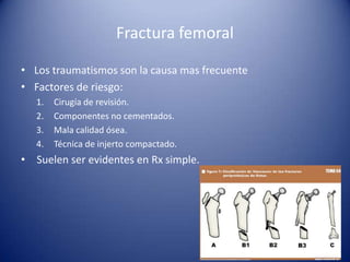 Fractura femoral
• Los traumatismos son la causa mas frecuente
• Factores de riesgo:
1.
2.
3.
4.

Cirugía de revisión.
Componentes no cementados.
Mala calidad ósea.
Técnica de injerto compactado.

• Suelen ser evidentes en Rx simple.

 