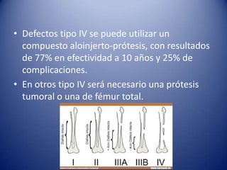 • Defectos tipo IV se puede utilizar un
compuesto aloinjerto-prótesis, con resultados
de 77% en efectividad a 10 años y 25% de
complicaciones.
• En otros tipo IV será necesario una prótesis
tumoral o una de fémur total.

 