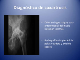 Diagnóstico de coxartrosis
• Dolor en ingle, nalga y cara
anteromedial del muslo
(rotación interna).

• Radiografías simples AP de
pelvis y cadera y axial de
cadera.

 