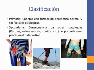 Clasificación
• Primaria: Caderas con formación anatómica normal y
sin factores etiológicos.
• Secundaria: Consecuencia de otras patologías
(Perthes, osteonecrosis, coxitis, etc.) o por sobreuso
profesional o deportivo.
 