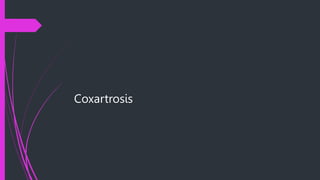 Coxartrosis
 